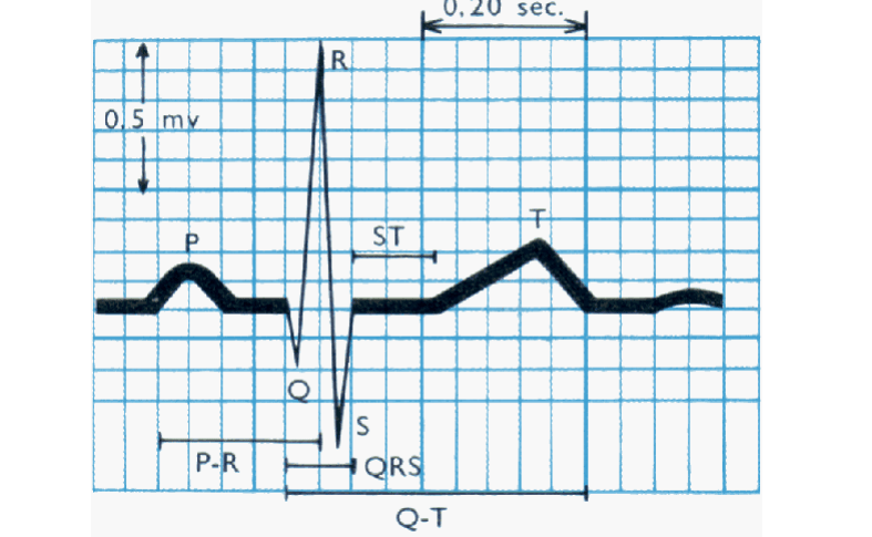 Tracé d’un électrocardiogramme