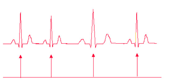 détection des battements cardiaques