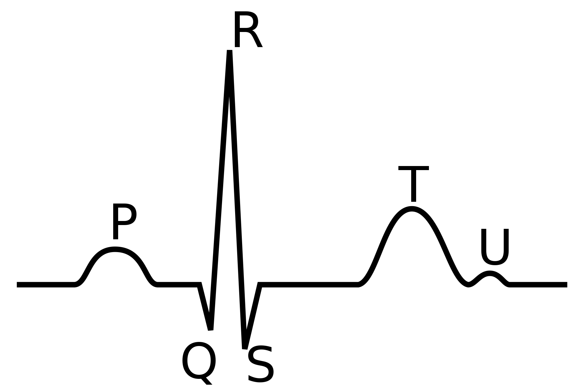 Signal ECG