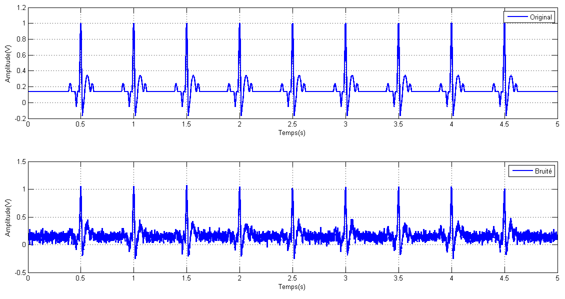 signal ecg et le bruit