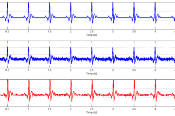 signal ecg filtré