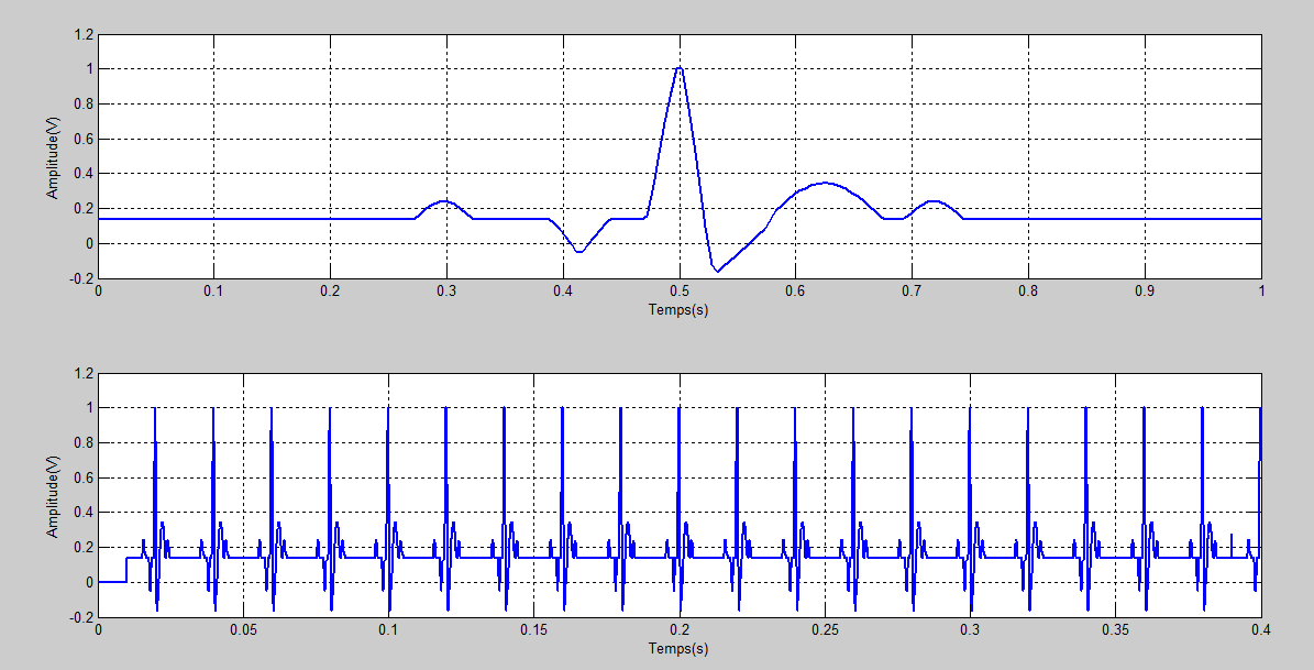 signal ecg périodique