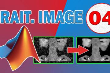 Le filtre médian avec Matlab